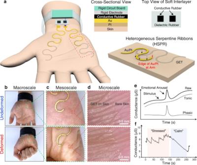 Palm e-tattoo can tell when you're stressed out image